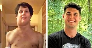 Watch: Tennessee Teen Drenched in Glyphosate Spent Next 7 Years Fighting ‘Massive Alien’ Tumor